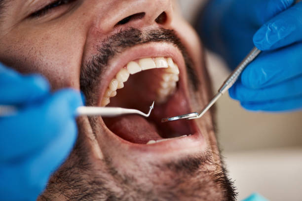 Best Urgent Dental Care  in Montello, WI